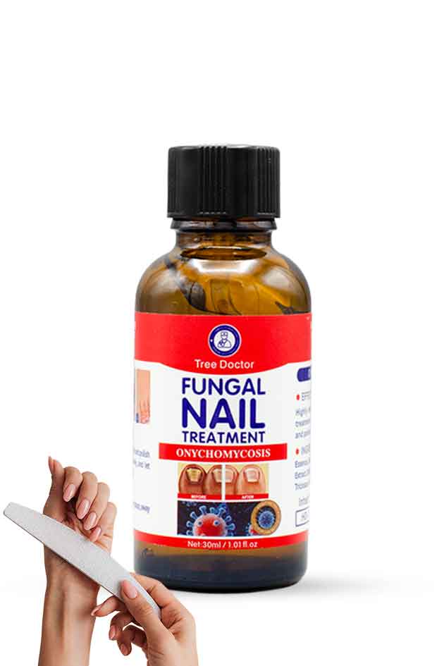 Yardlie Tree Doctor Fungal Nail Treatment Onychomycosis 30ml for damaged nails, Bottle of fungal nail treatment with a hand holding a nail file on a white background