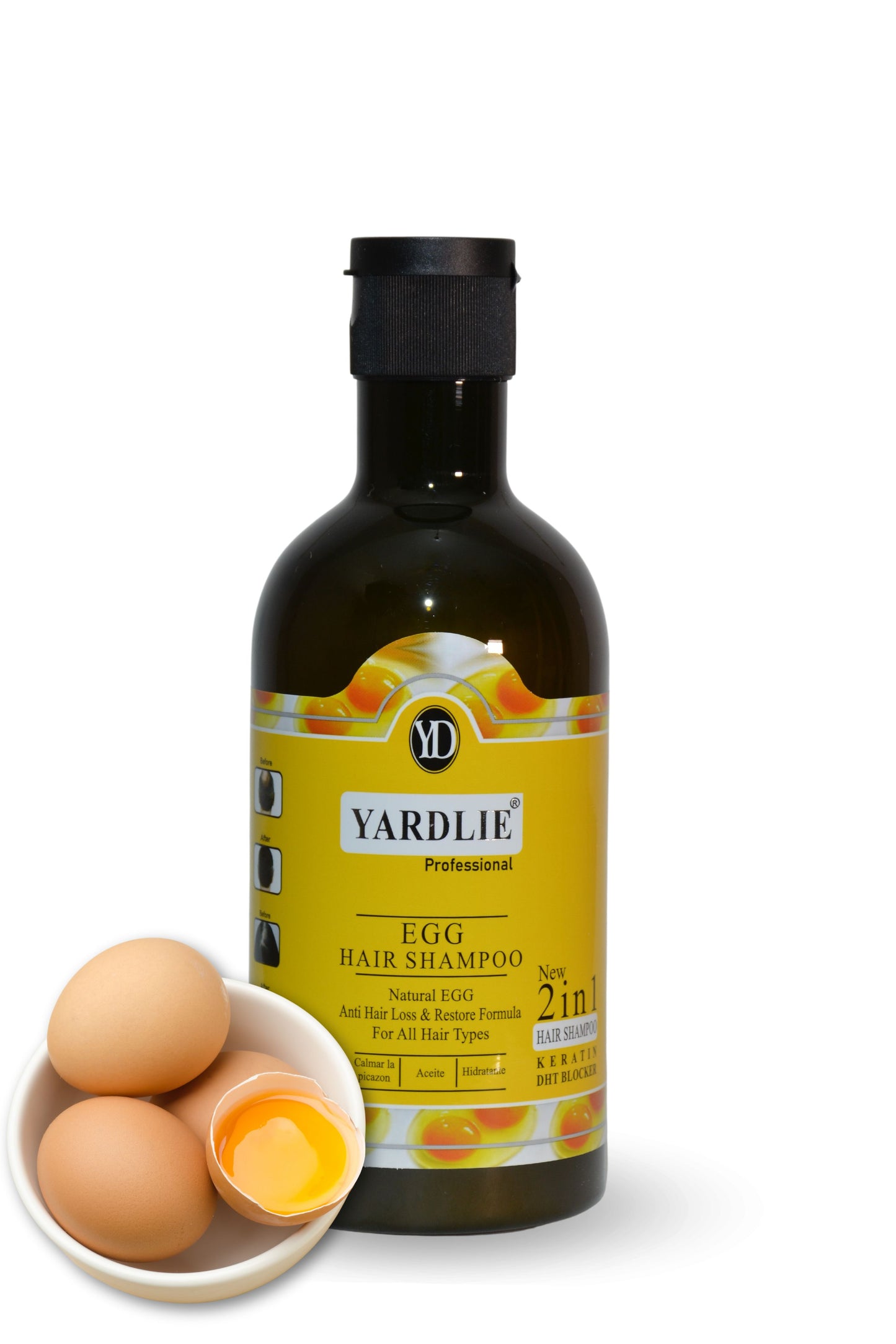 Yardlie Professional Advanced Hair Fall Solution Egg Shampoo 400g.